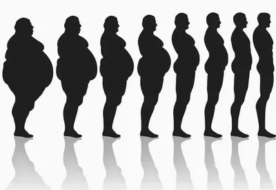 Ожирение - степени ожирения, лечение ожирения в НМИЦ радиологии