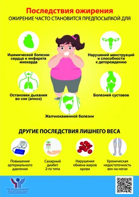 Ожирение — симптомы, причины, последствия | 07.03.2023 | Волжский -  БезФормата