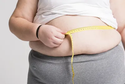 Минздрав назвал страдающие от ожирения регионы — РБК