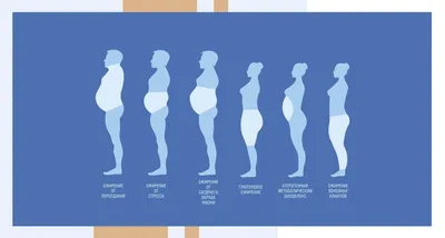 Ожирение на 30-70% повышает риск развития целого ряда онкозаболеваний» |  Статьи | Известия