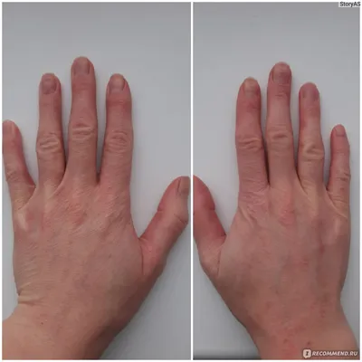 Снимки пальцев рук в движении