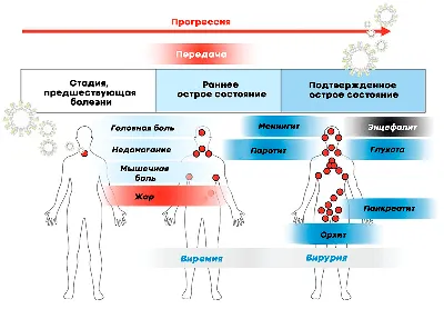 Эпидемический паротит. Заболевания.