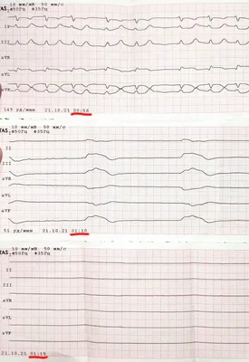 ЭКГ: истории из жизни, советы, новости, юмор и картинки — Горячее, страница  7 | Пикабу