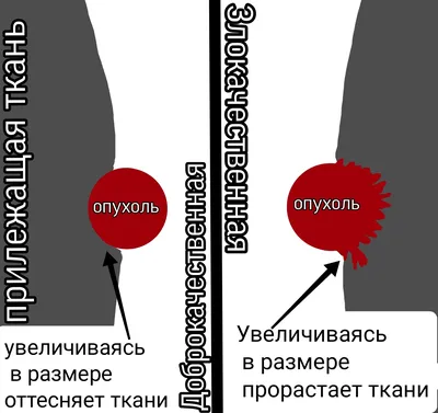 Патологическая анатомия для самых маленьких (выпуск 10) | Пикабу