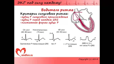 Урок 3. Видеокурс \"ЭКГ под силу каждому\". - YouTube