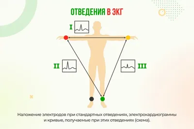 Кардиология: истории из жизни, советы, новости, юмор и картинки — Все  посты, страница 2 | Пикабу