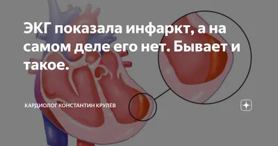 Что значит ЭОС, отклонение влево, вправо, вертикальная, горизонтальная.