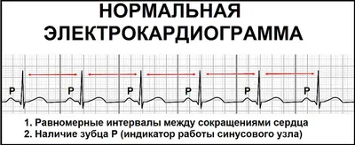 Определение электрической оси сердца