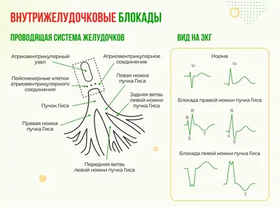 Ишемическая болезнь сердца (ИБС) - причины появления, симптомы заболевания,  диагностика и способы лечения