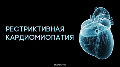 Регистратор ЭКГ холтеровский Валента МН-08, Россия › купить, цена в Москве,  оптом и в розницу