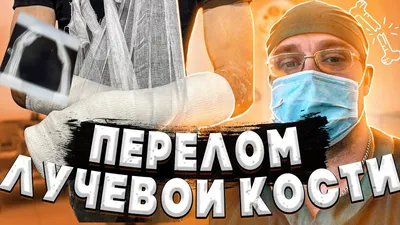 Перелом лучевой кости в типичном месте | Микрохирургия просто | Дзен