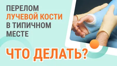 Перелом руки: как не допустить осложнений после перелома лучевой кости?  ВАЖНО! - YouTube