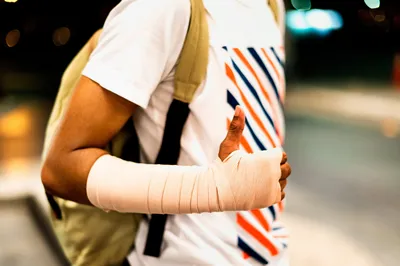 Фото перелома указательного пальца на руке