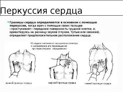 Пальпация перкуссия аускультация сердца: 2 тыс изображений найдено в Яндекс  Картинках