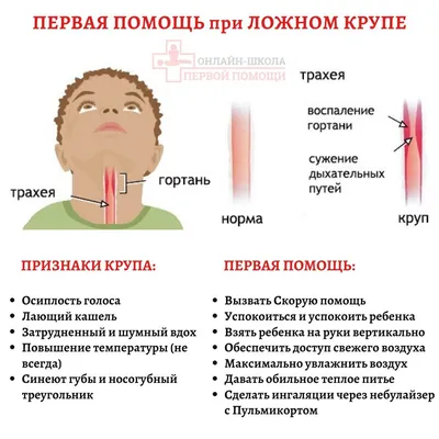 Профилактика пищевых отравлений у детей | МАДОУ \"Детский сад \"Колобок\"