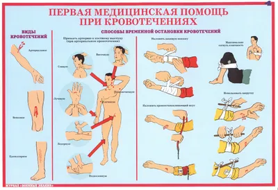 Основы первой помощи, которые нужно знать детям» (для населения) -  Государственное учреждение здравоохранения \"Детская областная больница\"