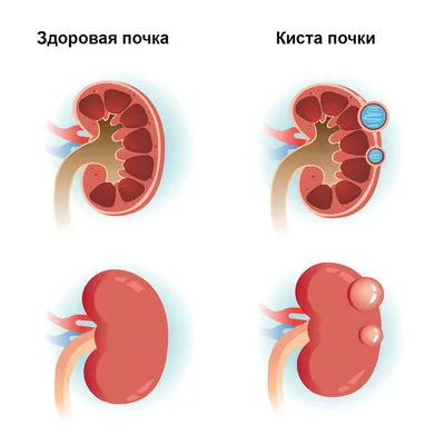 Почка человека купить – цена от ElizLabs