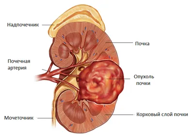 Sina (Китай): пять признаков, что у вас не в порядке почки! (Sina.com,  Китай) | 07.10.2022, ИноСМИ