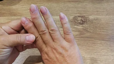 Изображение народных средств при лечении полиартрита пальцев рук