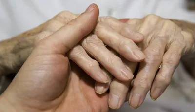 Картинка симптомов полиартрита пальцев рук