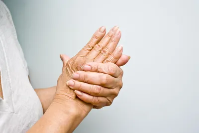 Изображение профилактики полиартрита пальцев рук