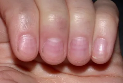 Изображение полос на ногтях рук: близкий план на аккуратный маникюр