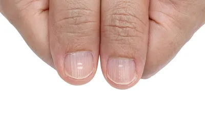 Фото полос на ногтях рук на разных длинах ногтей