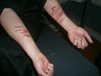 Фото порезов на руках: близкий план раны