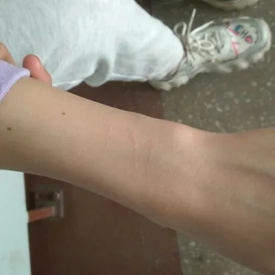 Фотки порезов на руках: настоящие примеры травм
