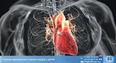 Приобретенные пороки сердца - презентация онлайн