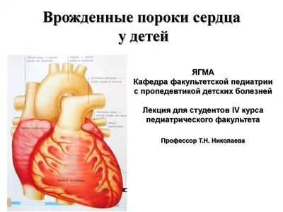 Врожденный порок сердца, причины | genetyka.com.ua