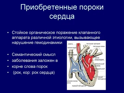 Врожденные и приобретенные пороки сердца», СРС, патологическая анатомия |  Презентации Патологическая анатомия | Docsity
