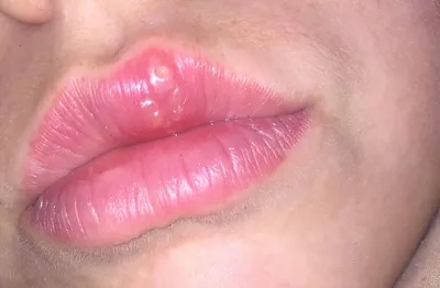 Картинка губ после татуажа с использованием макияжа
