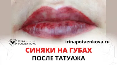 Фотография татуажа губ: простой и безопасный процесс