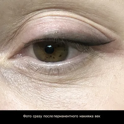 Изображения нарушений после татуажа