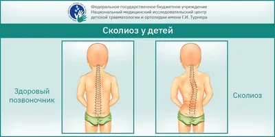 3d вид позвоночника, изображения позвоночника человека фон картинки и Фото  для бесплатной загрузки