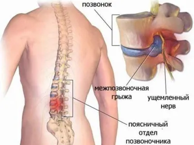 Модель позвоночника с нервами, полноразмерная анатомическая модель  позвоночника с подставкой | AliExpress