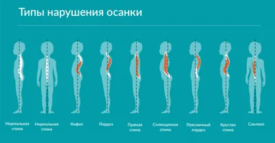 Рекомендации для развития здоровой осанки у ребенка