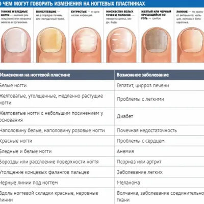 Продольные полосы на ногтях рук в формате WebP