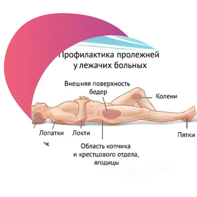 Лечение длительно незаживающего пролежня | УВТ | МЦ \"Аватаж\"