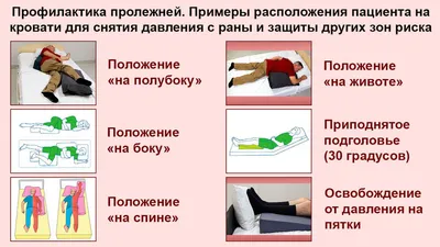 Пролежни: осложнения, особенности лечения и профилактика