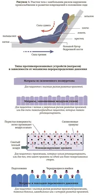 Профилактика пролежней и уход за пациентами +аудио