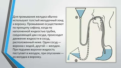 Содержание 1. Проведение промывания желудка с помощью зонда (на фантом