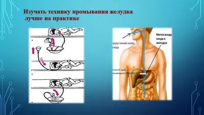 Дневник фельдшера скорой помощи. Вызов на отравление таблетками | Пикабу