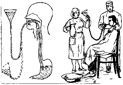 Промывание желудка толстым зондом презентация - 93 фото
