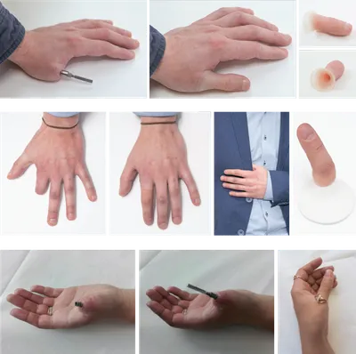 Фотографии протезов пальцев рук в высоком разрешении