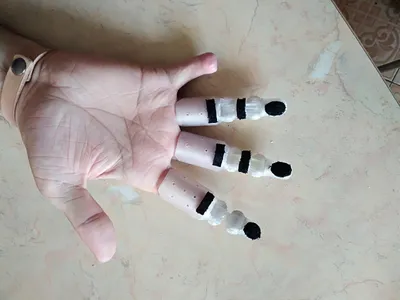 Фотографии протезов пальцев рук в деталях