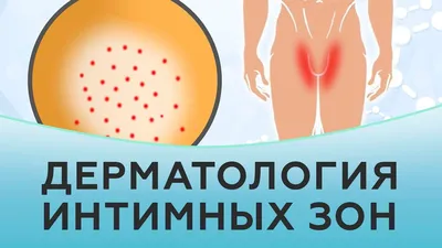 Проблемы интимных зон: какие дерматологические заболевания поражают  интимные органы