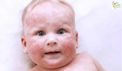 Почему краснеет кожа лица: 8 неочевидных причин - Новости здоровья -  Здоровье 24