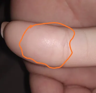 Пузырьки на пальцах рук: картинка с эффектом ретро